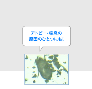 アトピー・喘息の原因のひとつにも！