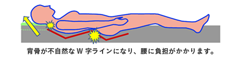 背骨が不自然なW字ラインになり、腰に負担がかかります。