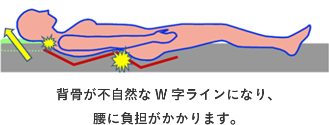 背骨が不自然なW字ラインになり、腰に負担がかかります。