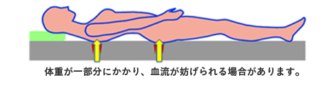 体重が一部分にかかり、血流が妨げられる場合があります。