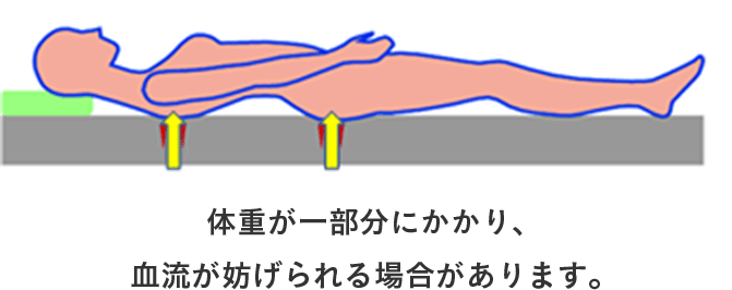 体重が一部分にかかり、血流が妨げられる場合があります。